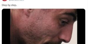 一步一脚印！哈弗茨晒康复训练视频，名记称他本赛季仍有复出可能